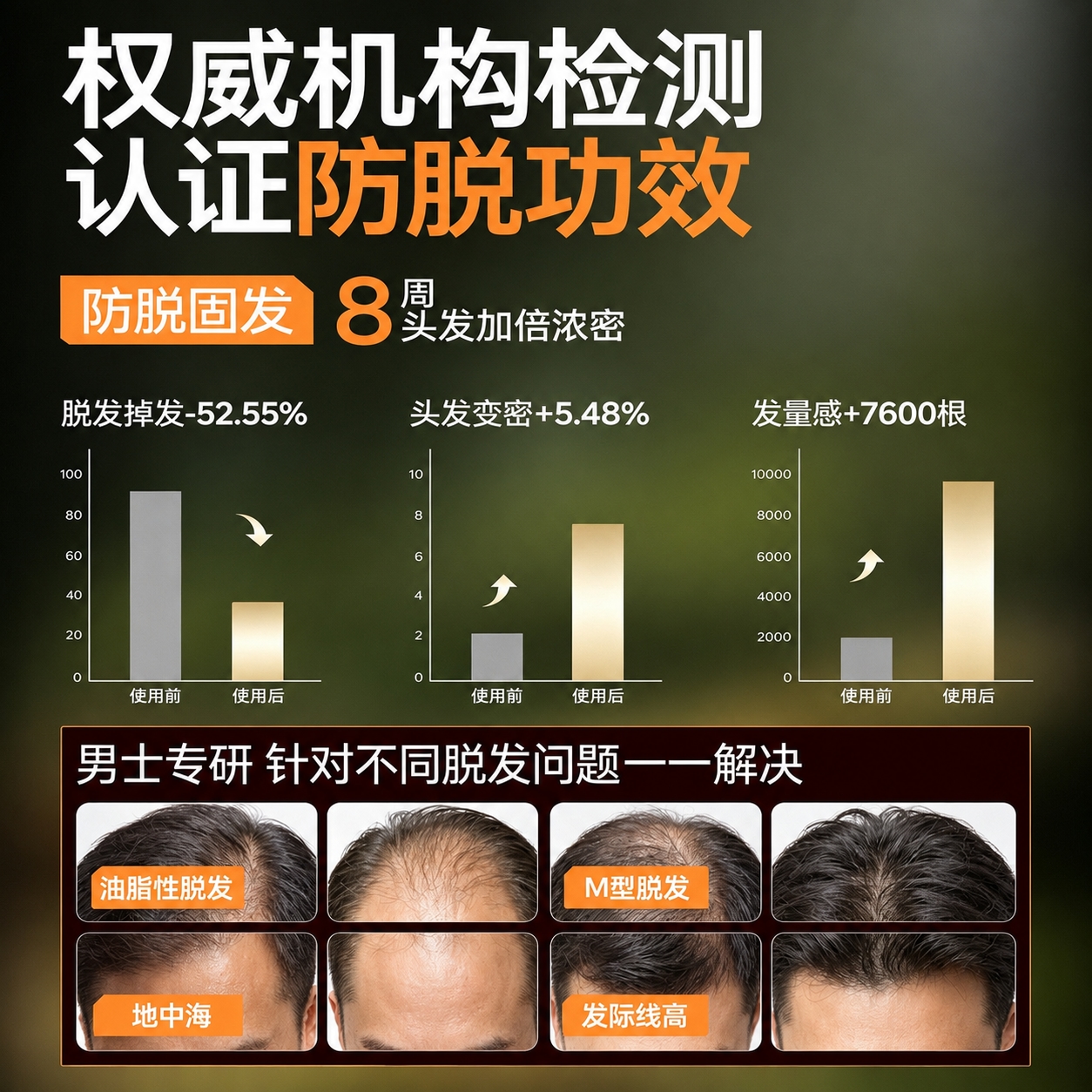 Hair Loss Prevention Shampoo 300ml