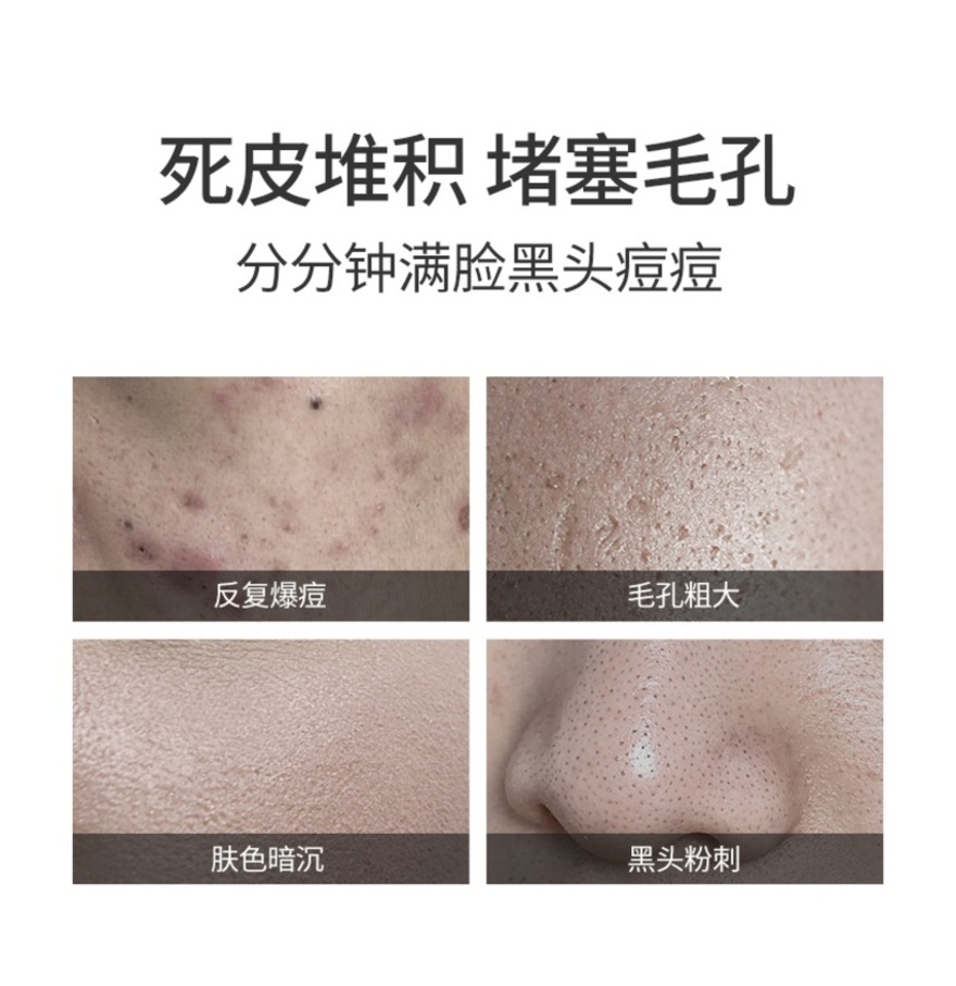 Face Exfoliating Gel 150g