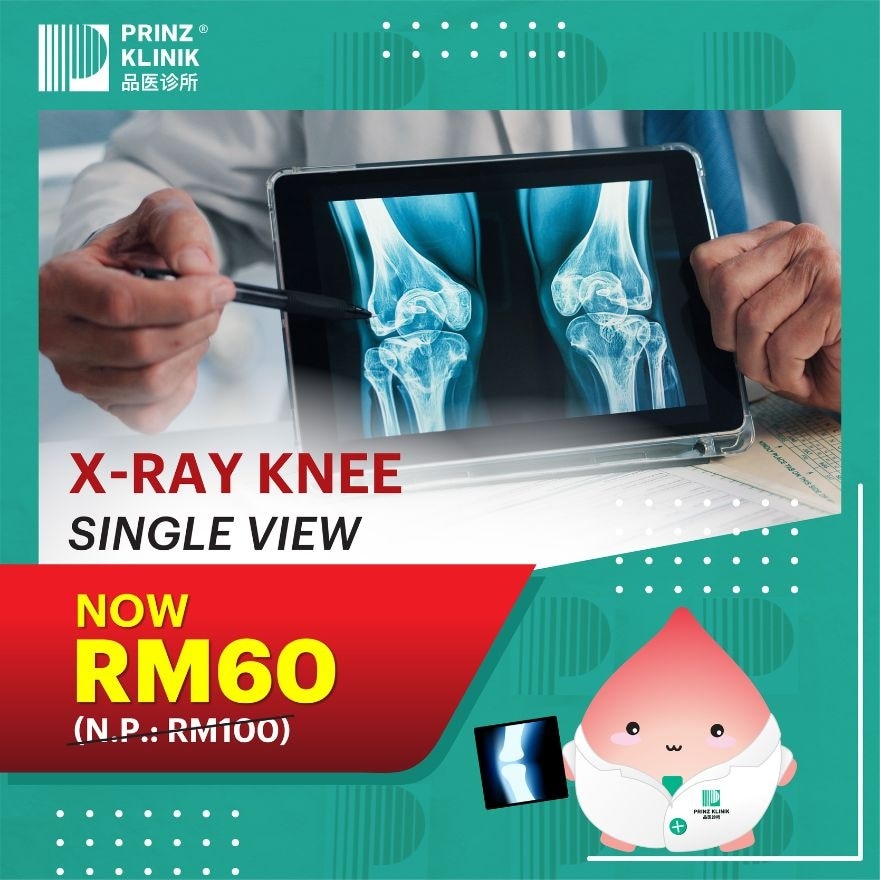 X-Ray Knee