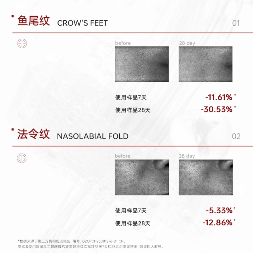 Bifida Ferment Lysate Anti Wrinkle Firming Single Use Essence 5pcs