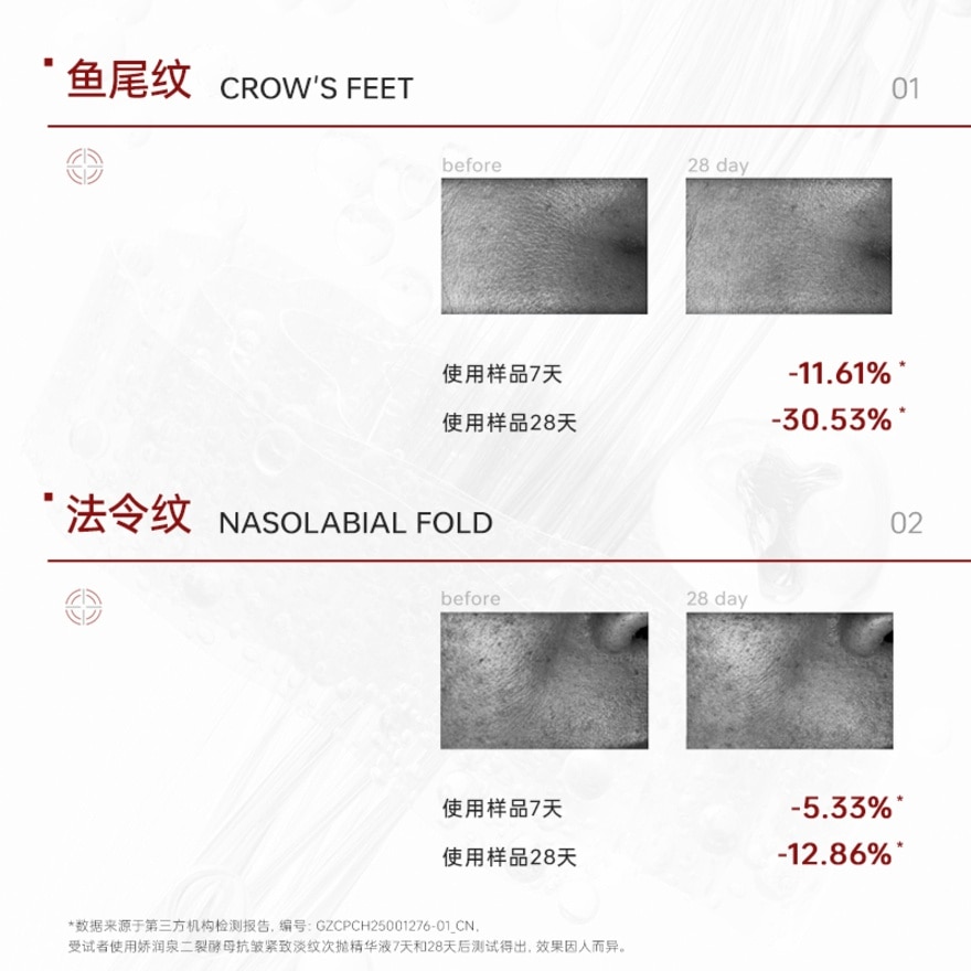 BIFIDA FERMENT LYSATE ANTI WRINKLE FIRMING SINGLE USE ESSENCE 5pcs