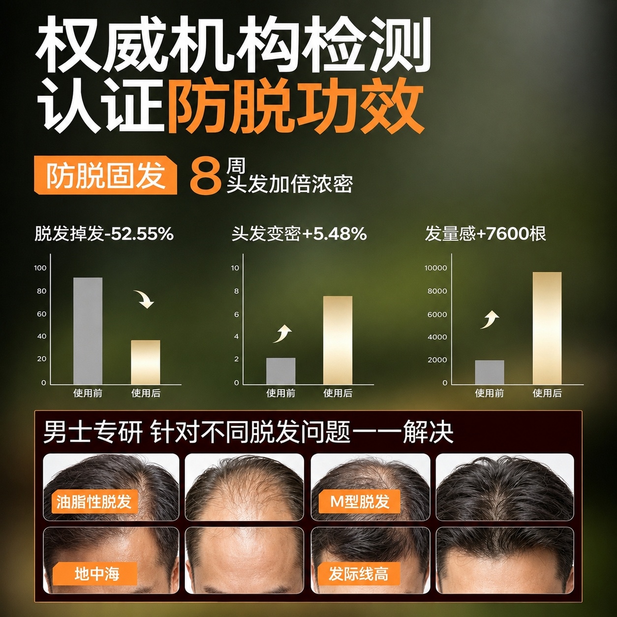 Hair Loss Prevention Shampoo 300ml