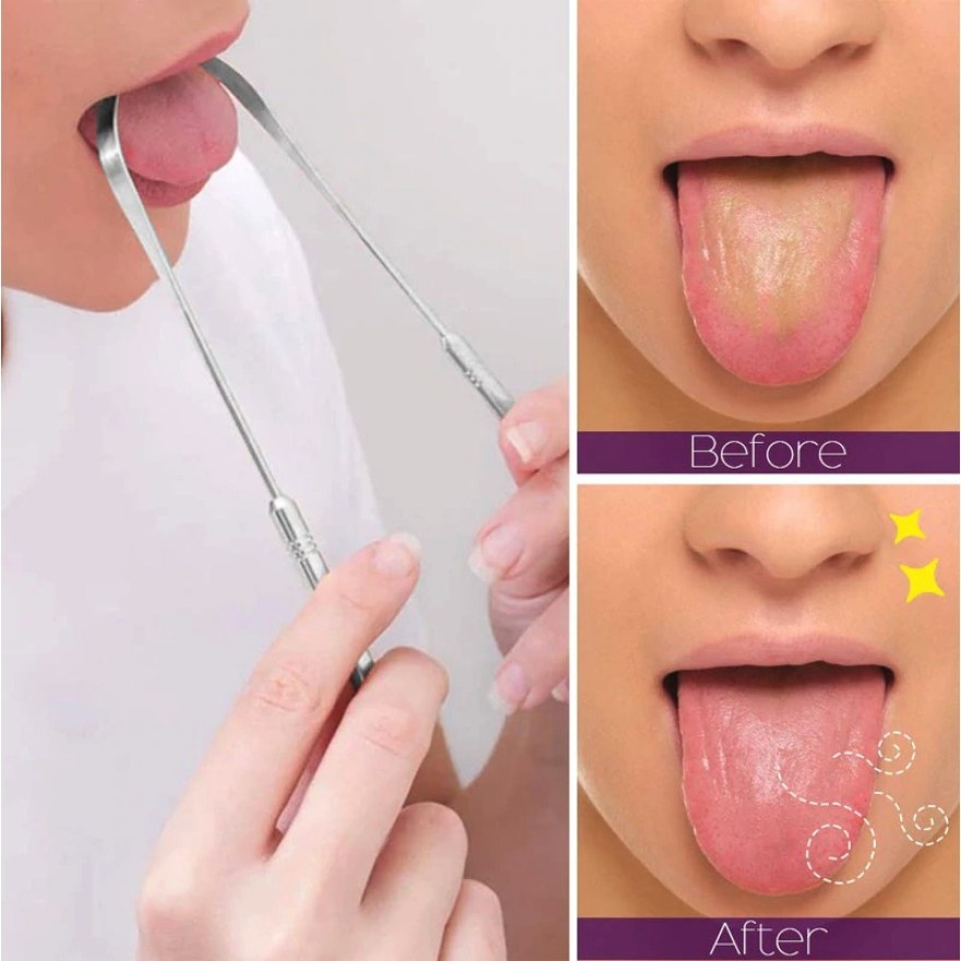 3PCS Stainless Steel Tongue Scrapper Cleaner