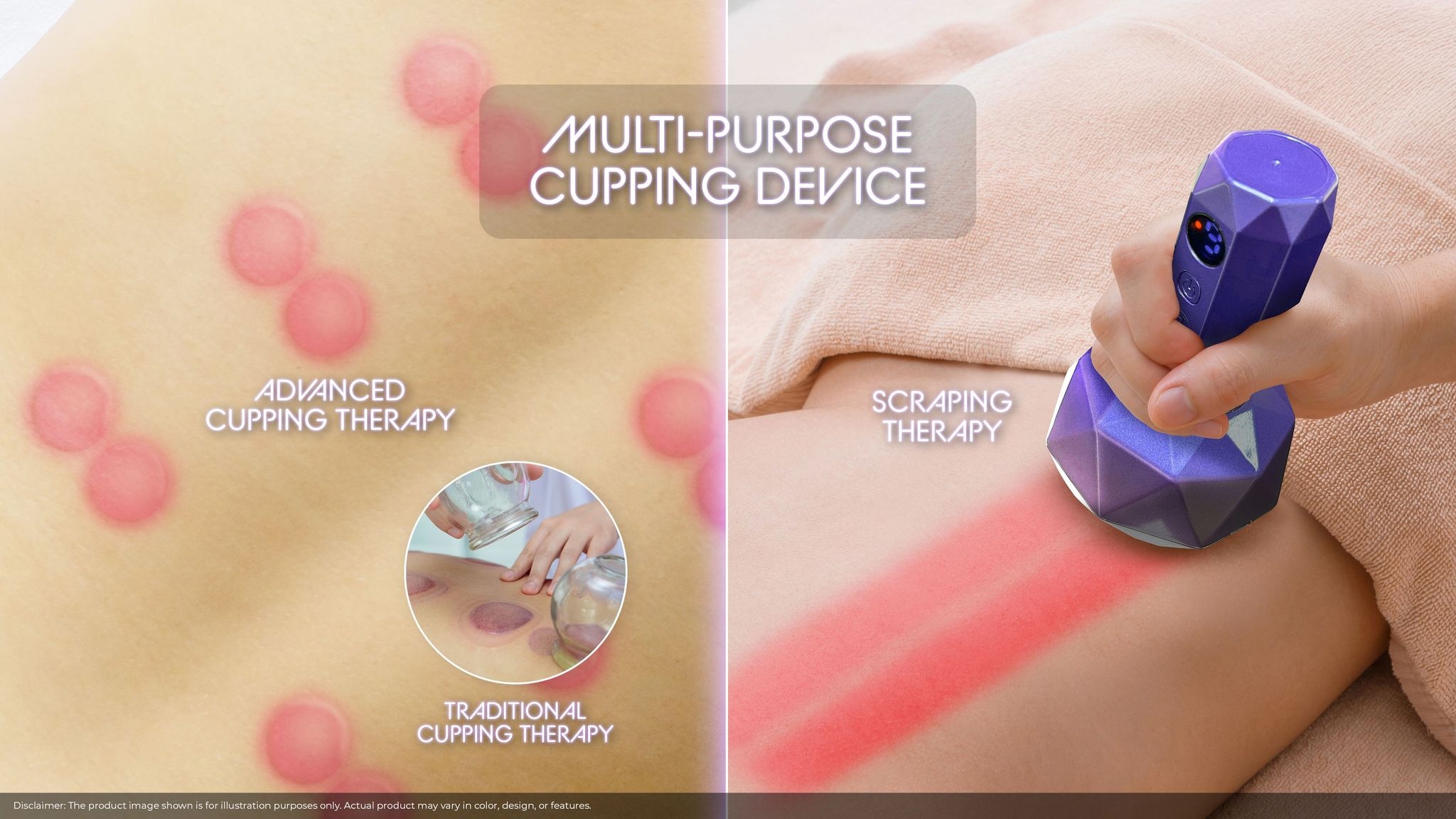 [Newly Launched] GINTELL G-Sona Cupping Device GT357