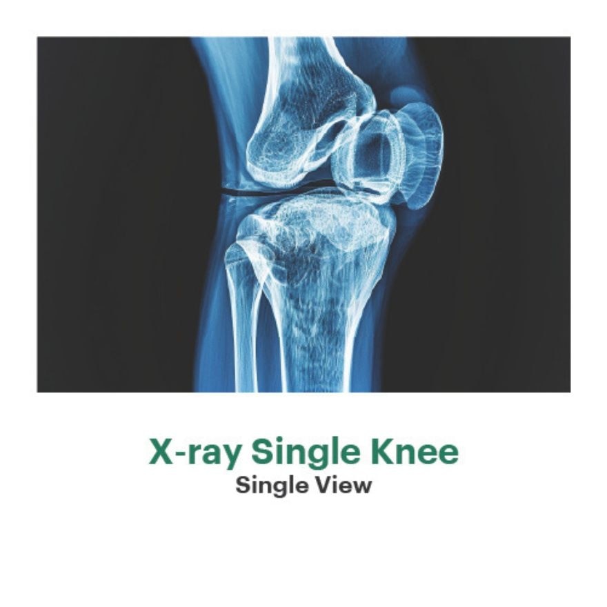 X-Ray Knee