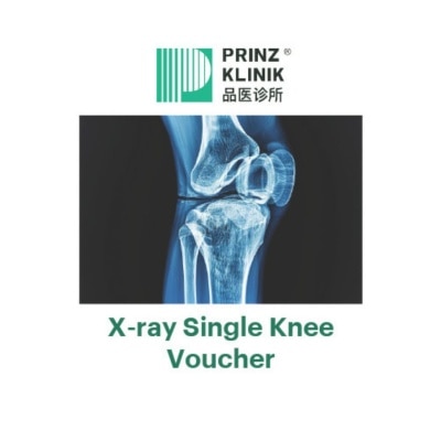 PRINZ KLINIK - X-Ray Knee