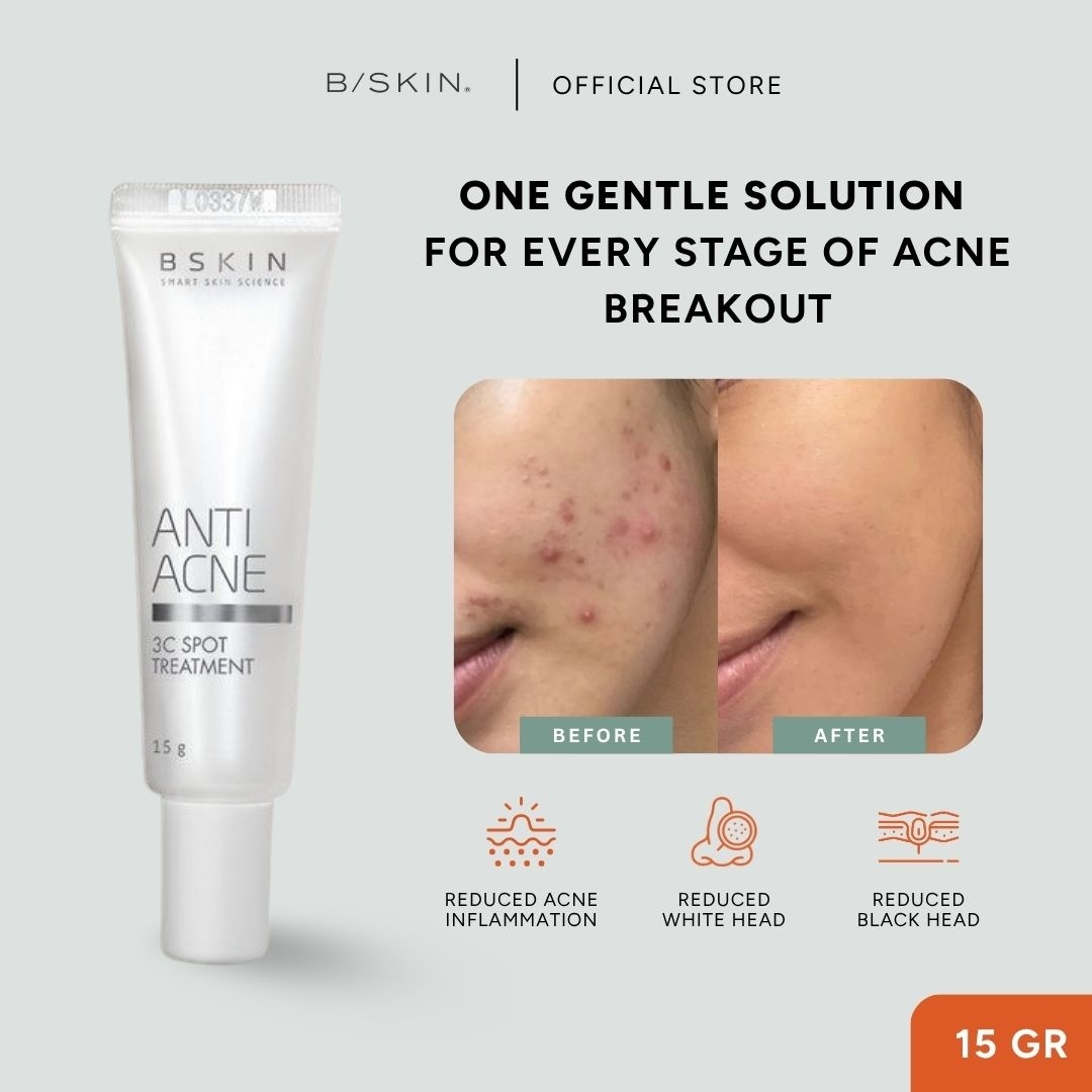 SKIN Anti Acne Spot Treatment Serum (15g) image