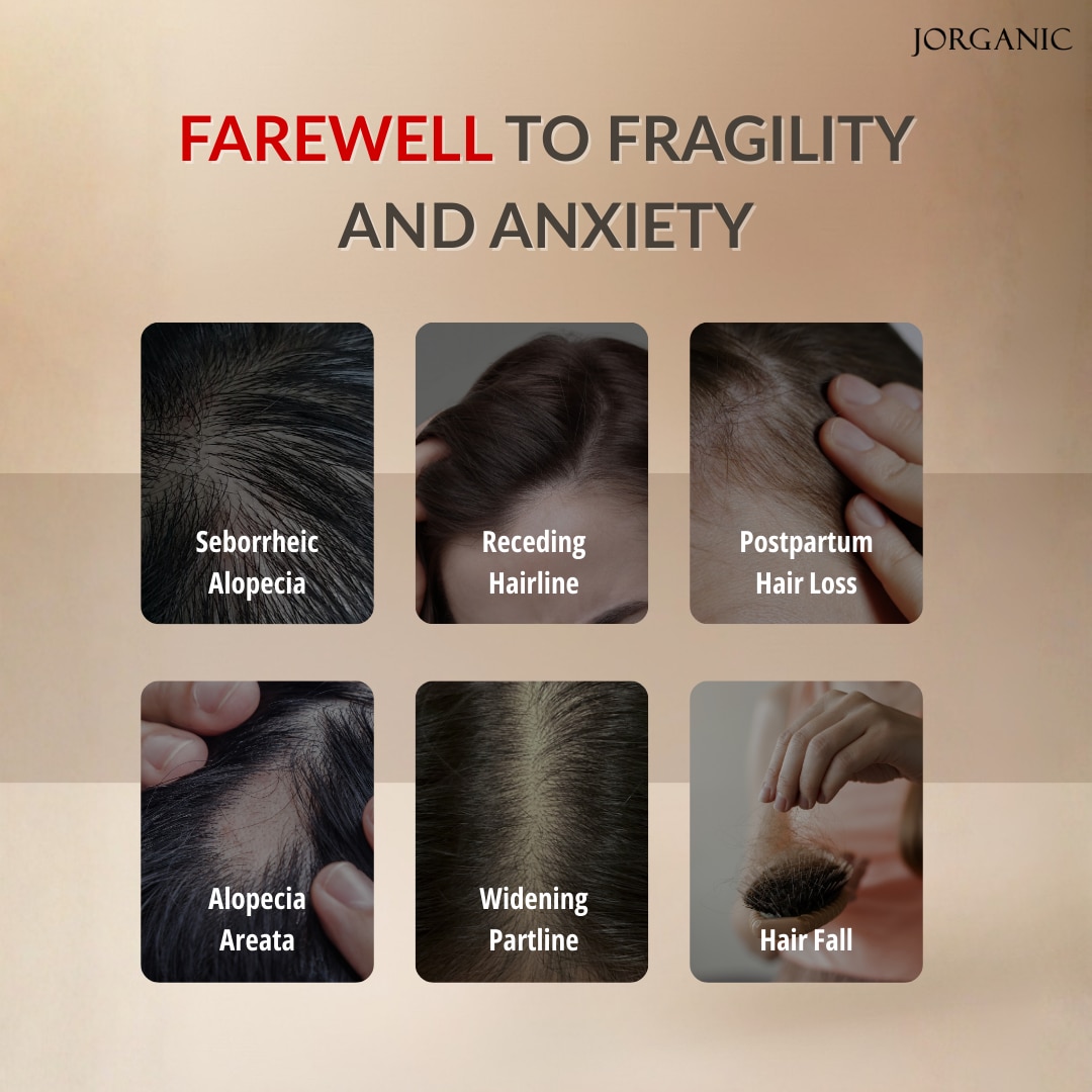 JORGANIC Renewelle Anti-Hair Loss Shampoo 300ml