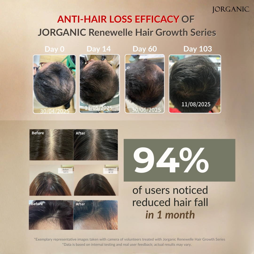 JORGANIC Renewelle Hair Growth Gift Set (Shampoo + Treatment + Tonic)