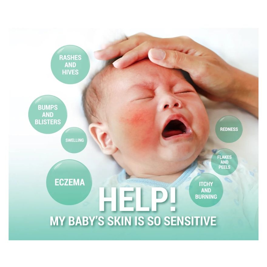 Cherub Rubs Skin Soothe 200ml