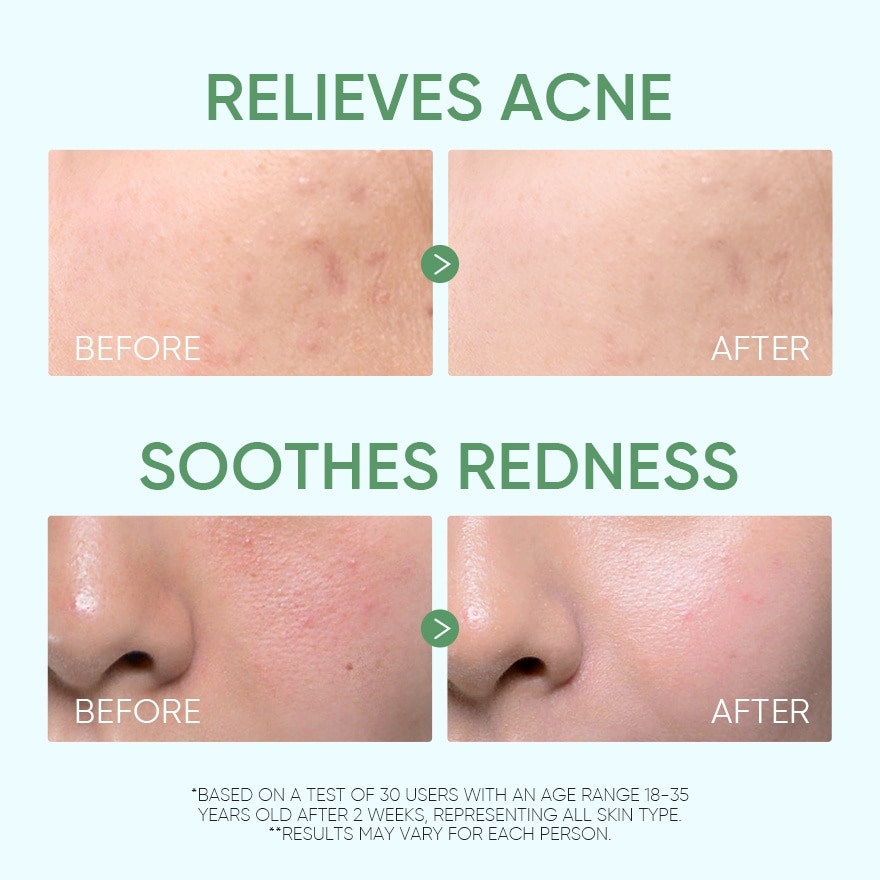 Pure Centella Acne Calming Toner 80ml