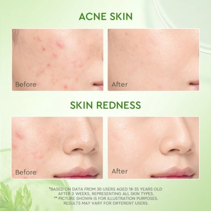 Mugwort Salicylic Acid Acne Clay Stick 25g