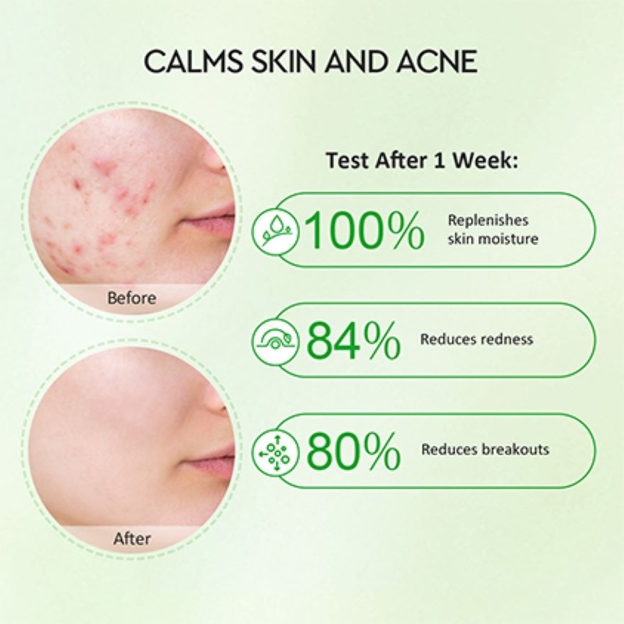 Centella Allantoin Soothing Gel Moisturizer 30g