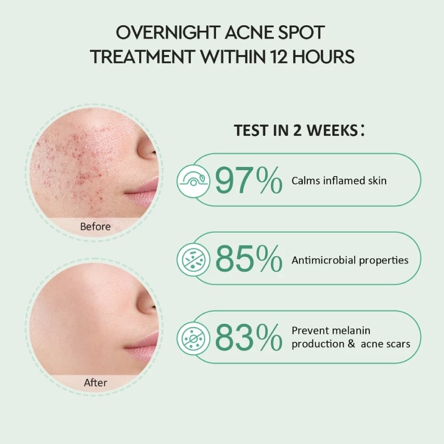 Centella Salicylic Acid Overnight Acne Spot Treatment 5g