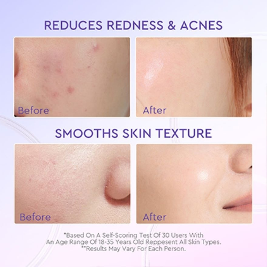 Blueberry Ceramide Barrier Repair Moisturizer 30g