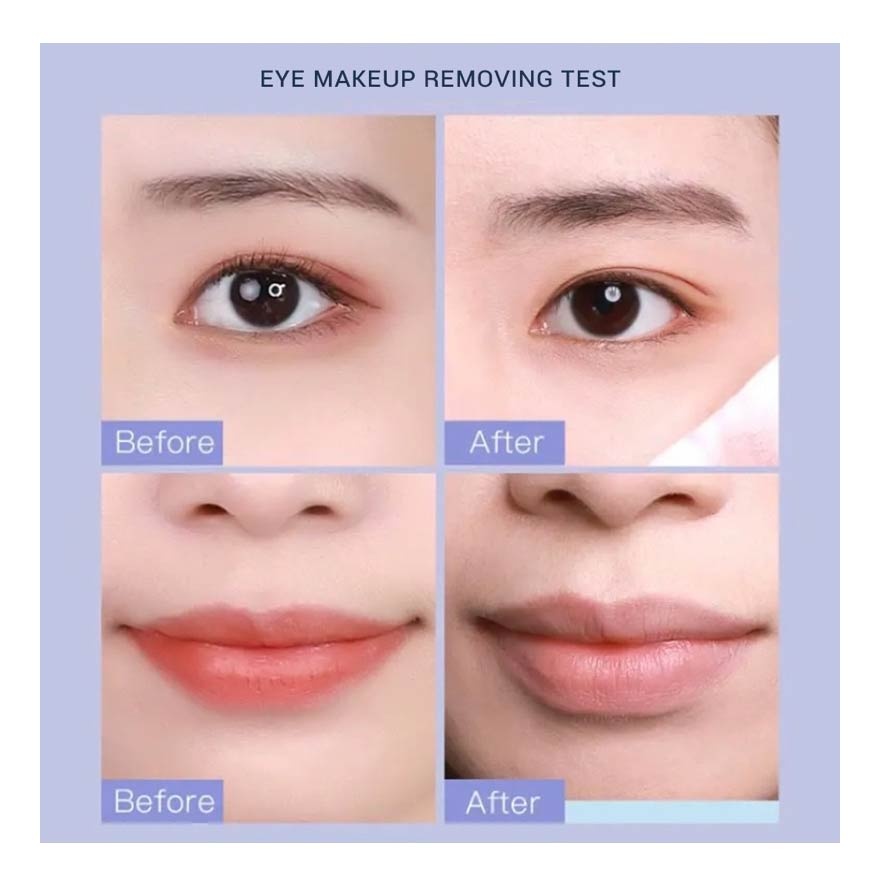 Makeup Remover