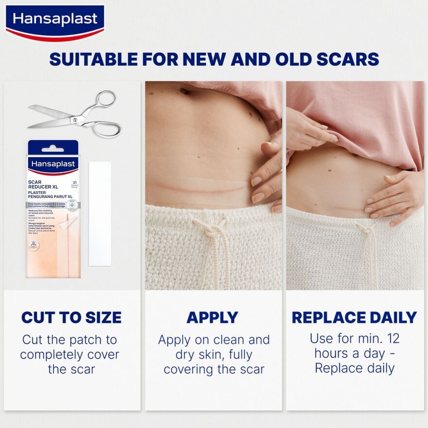 Scar Reducer Plaster XL 21's