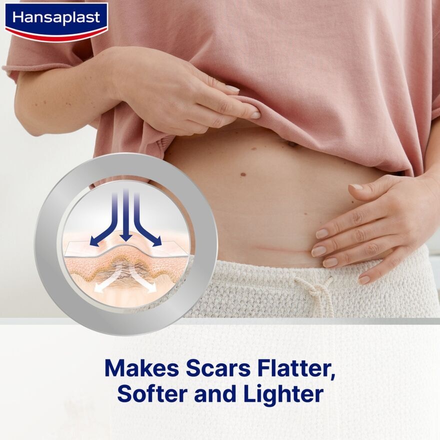 Scar Reducer Plaster XL 21's