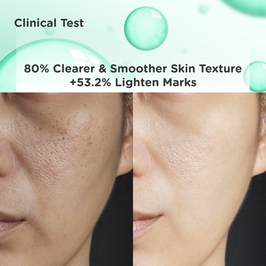 Sebumclar 2% BHA Exfoliating Liquid 160ml image