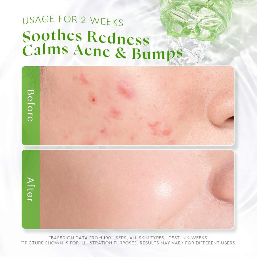 Centella Ceramide Soothing Toner 80ml image