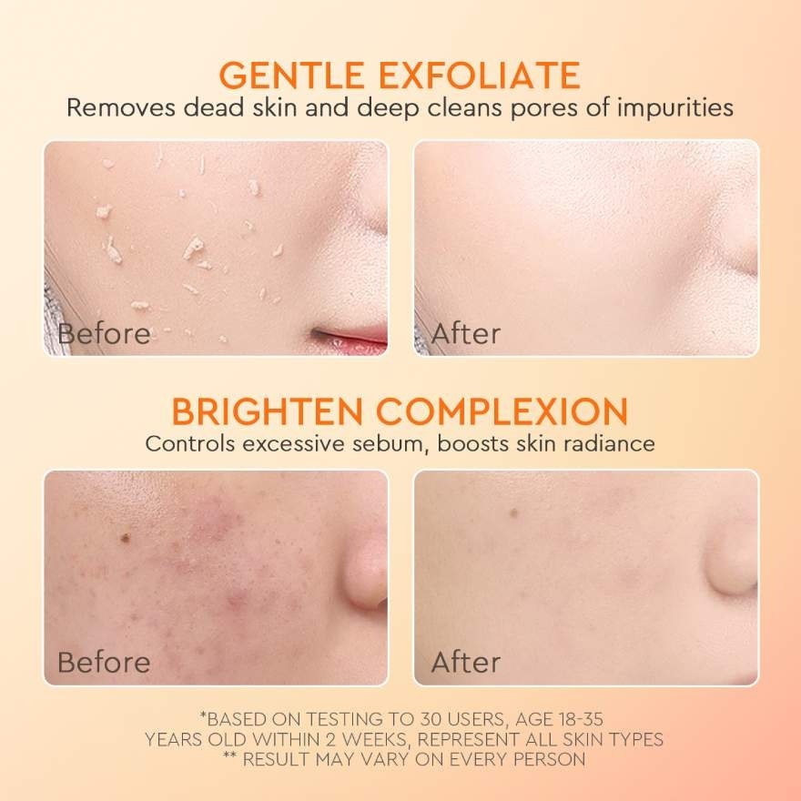 Apricot Glycolic Acid Exfo Smooth Peeling Gel 50g
