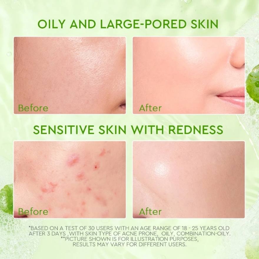 Centella Salicylic Acid Acne Gel Cleanser 70ml image