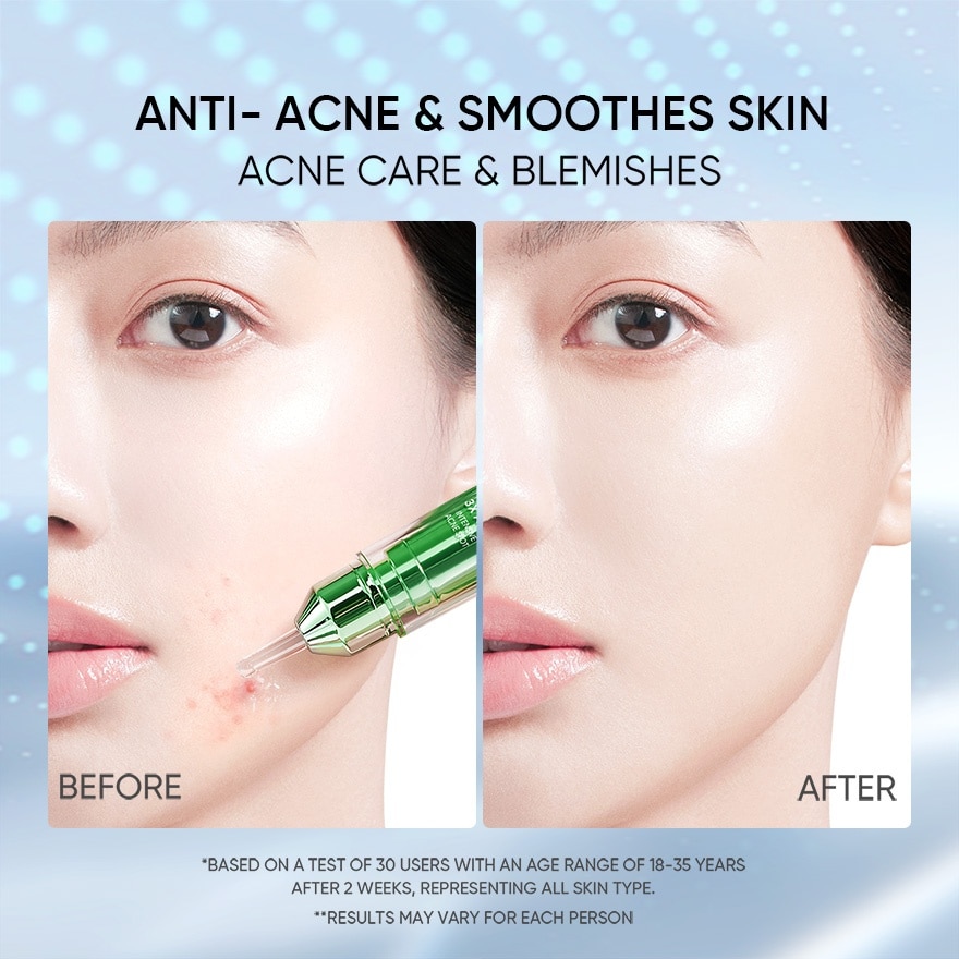 3X Acid Intensive Acne Spot 11g