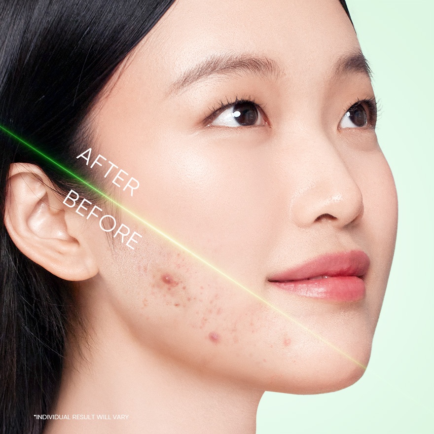 3X Acid Acne Gel Cleanser 120ml image