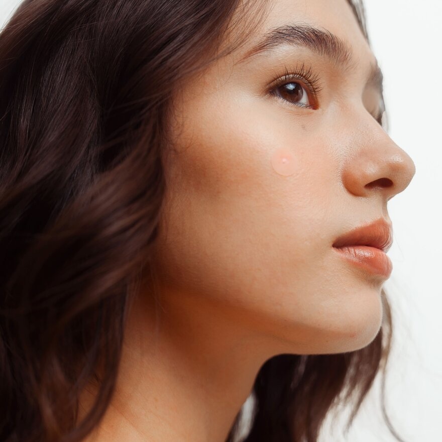 Goteskin Clear-It Acne Patches 12s image