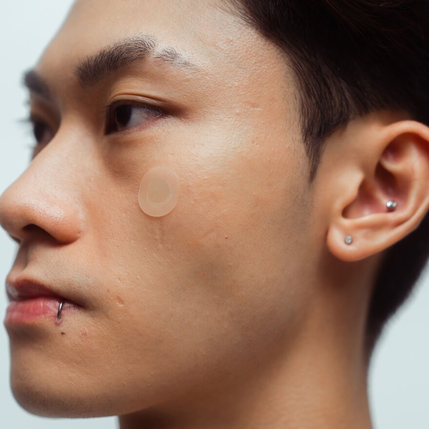 Goteskin Early-On Acne Patches 9s