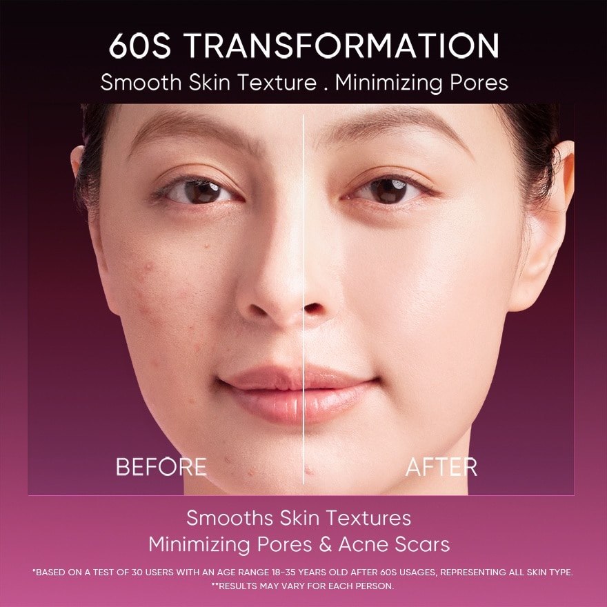 12% AHA BHA PHA LHA Peeling Solution 30ml