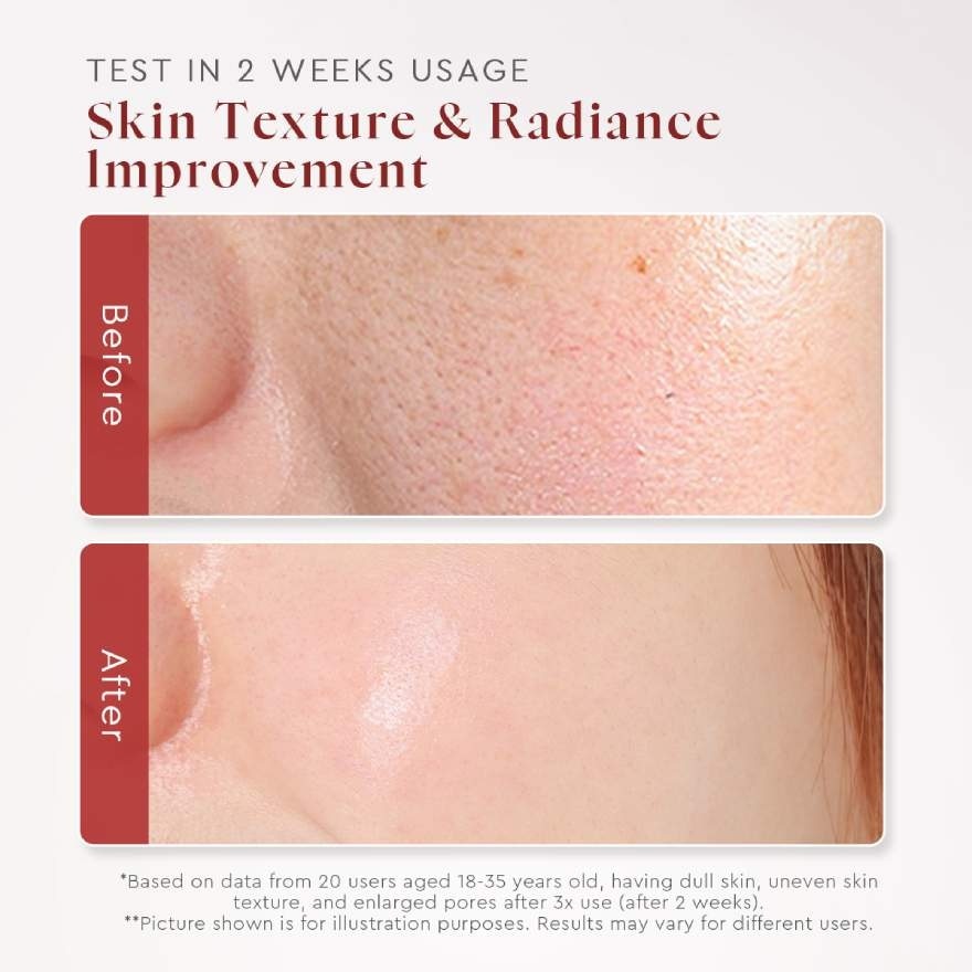 AHA BHA PHA Intensive Peeling Solution 15ml