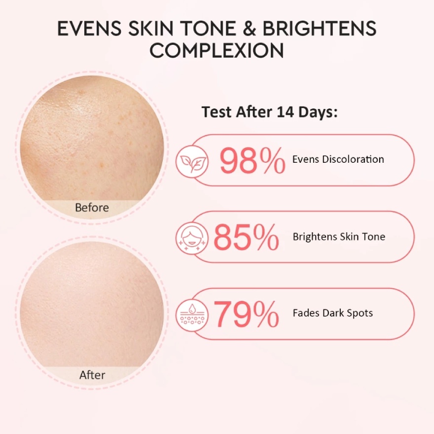 Pomegranate Brightening Kit (Serum 17ml+Moisturizer 30g)
