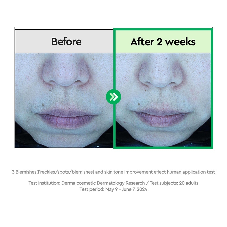 AC Deep Blemish Calming Mask 1s