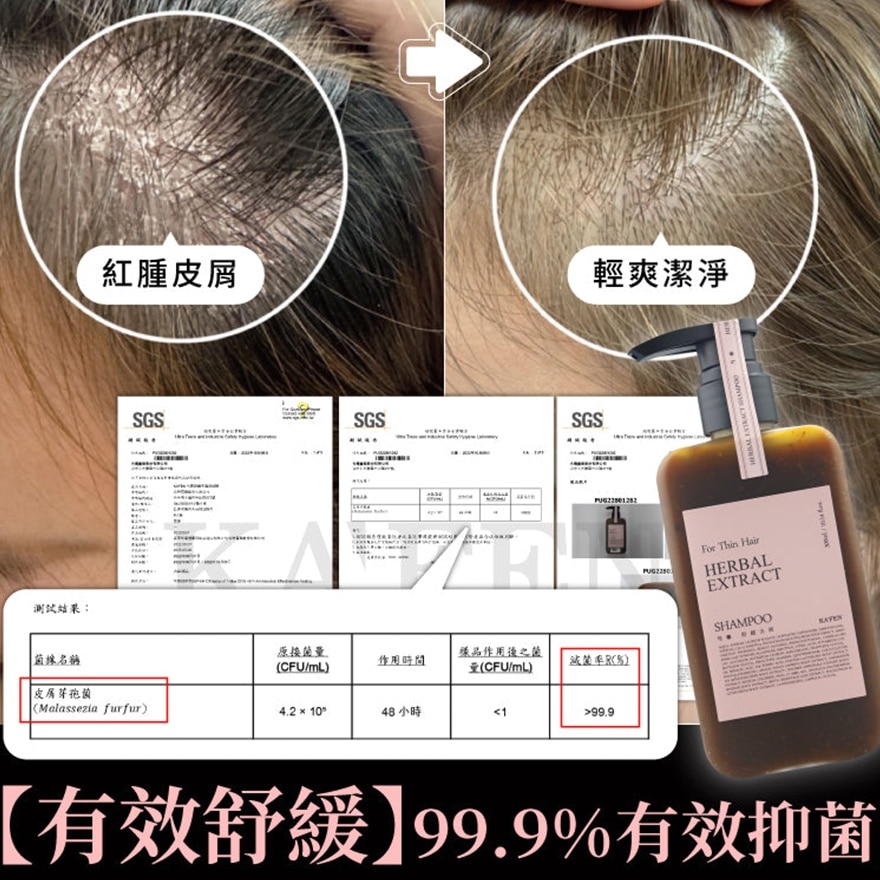 Herbal Extract Paeonia Lactiflora Shampoo 300ml (Gently cleans and soothes sensitive scalps)