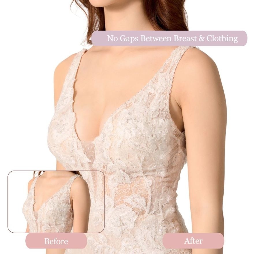 Double-Sided Adhesive Nude Bra (Size A)