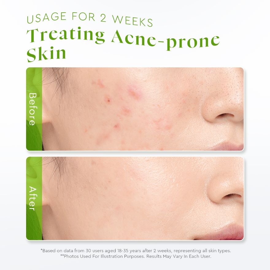 Centella Allantoin Soothing Gel Moisturizer 100g image