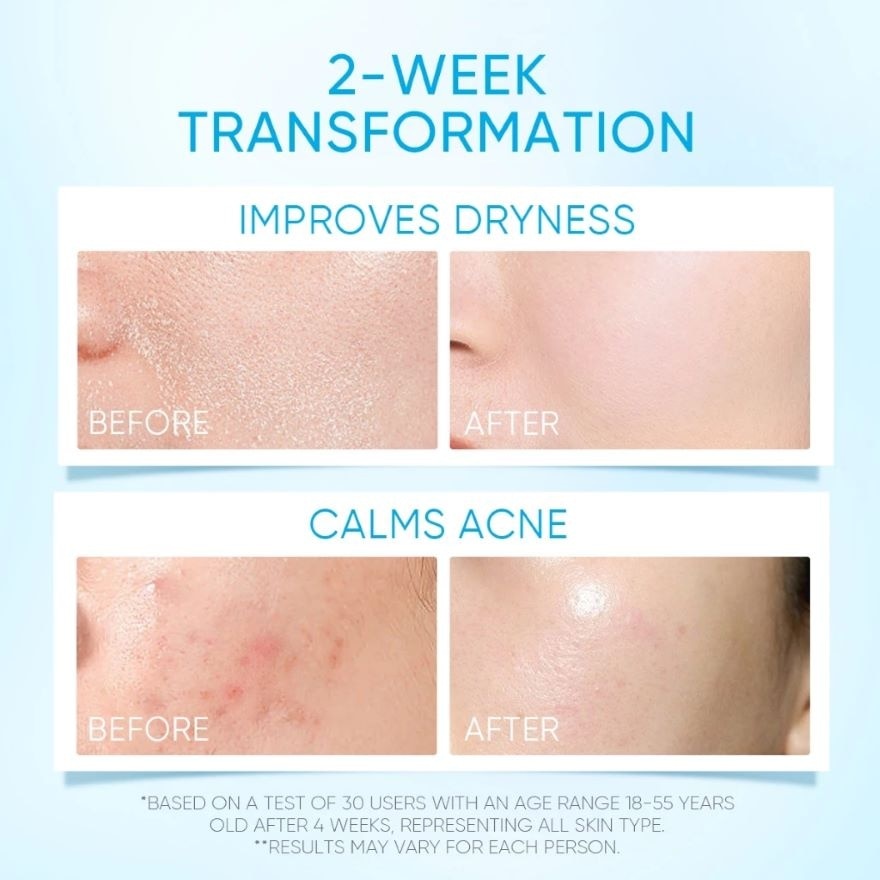 5X Ceramide Kit