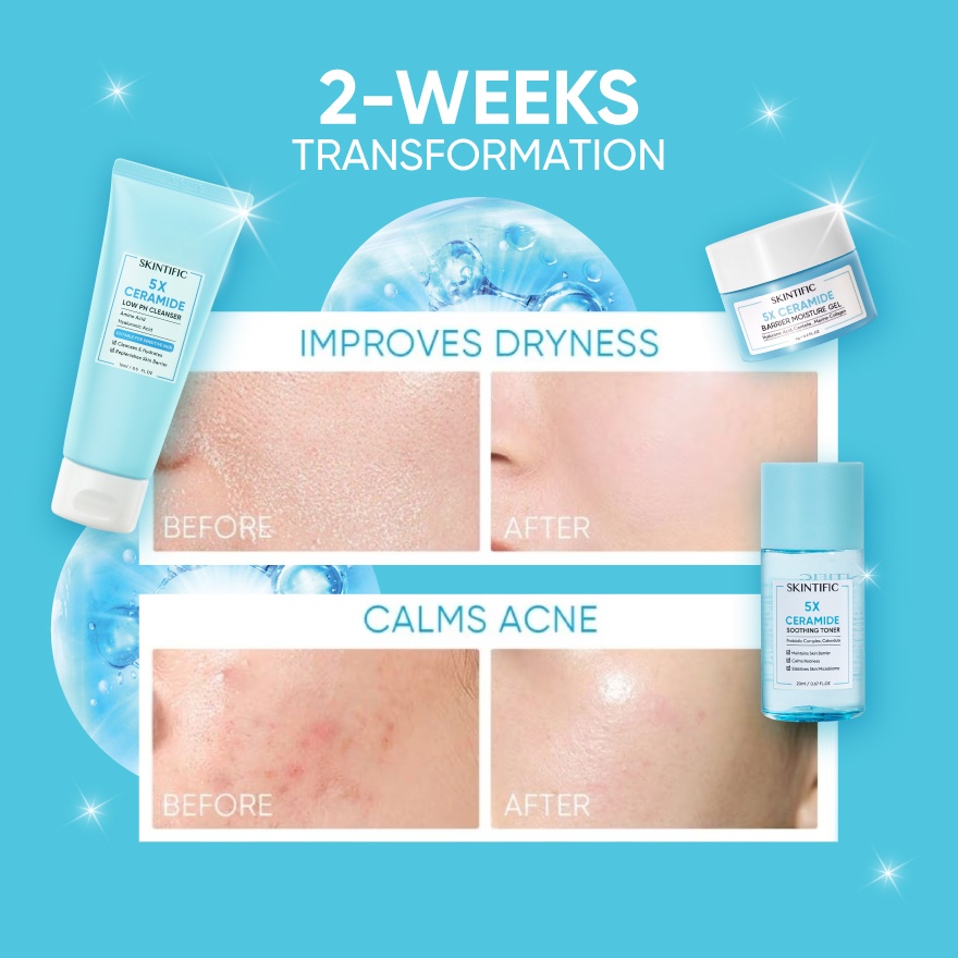 5X Ceramide Repair Barrier Kit image