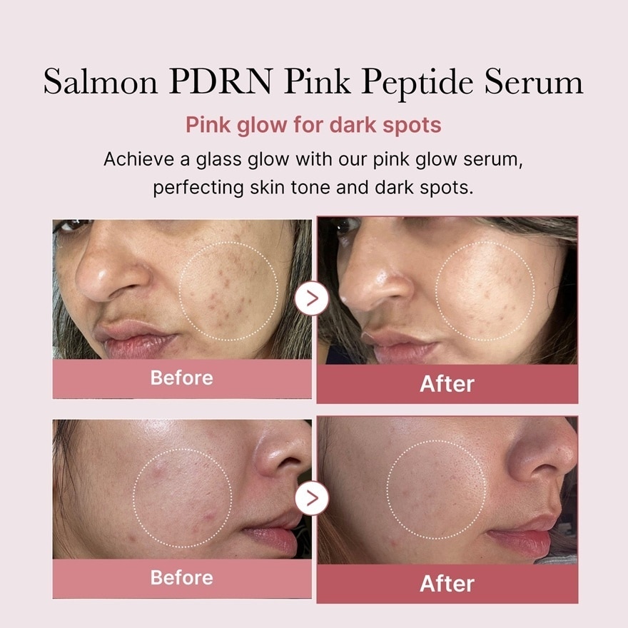 PDRN Pink Peptide Brightening Glow Serum 30ml