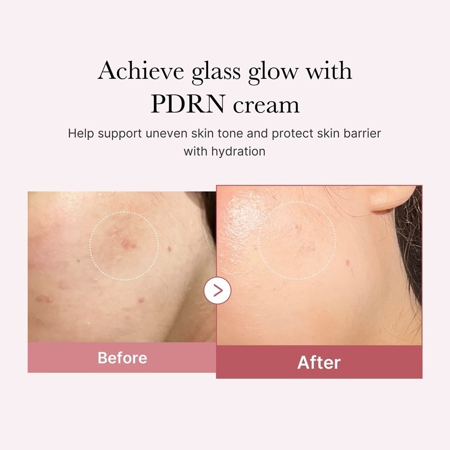 PDRN Pink Hyaluronic Moisturizing Cream 50ml