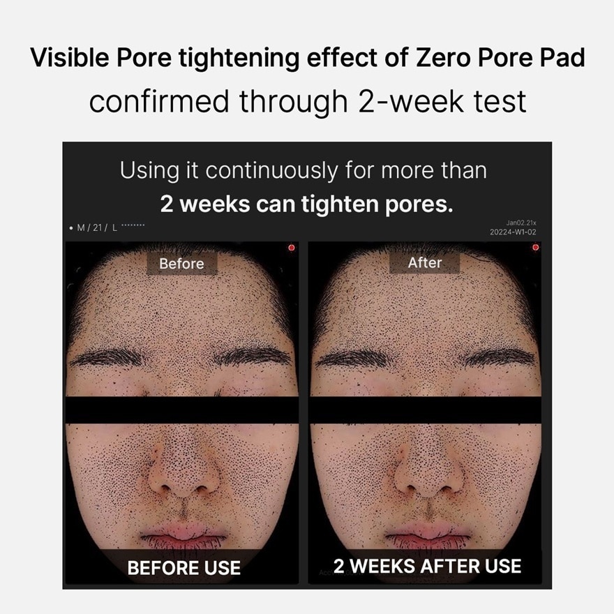 Zero Pore Pad 2.0 70s