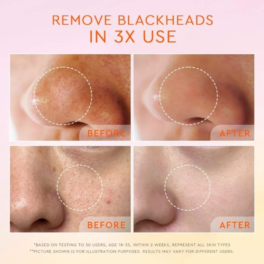 Yuzu AHA Blackhead Exfoliating Cleanser 70ml