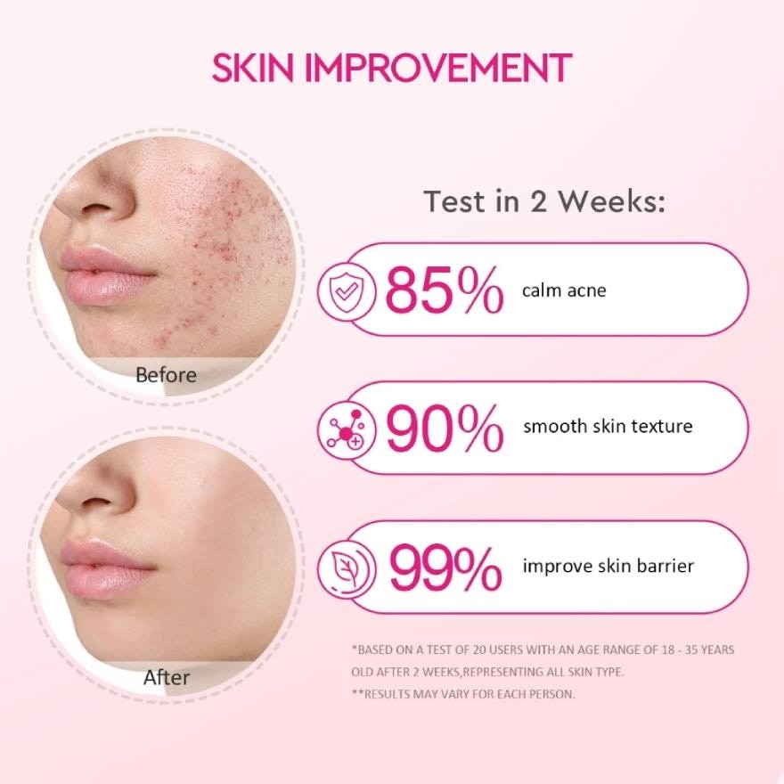 Peach Retinol Smoothing Kit (Serum 17ml + Moisturizer 30g)