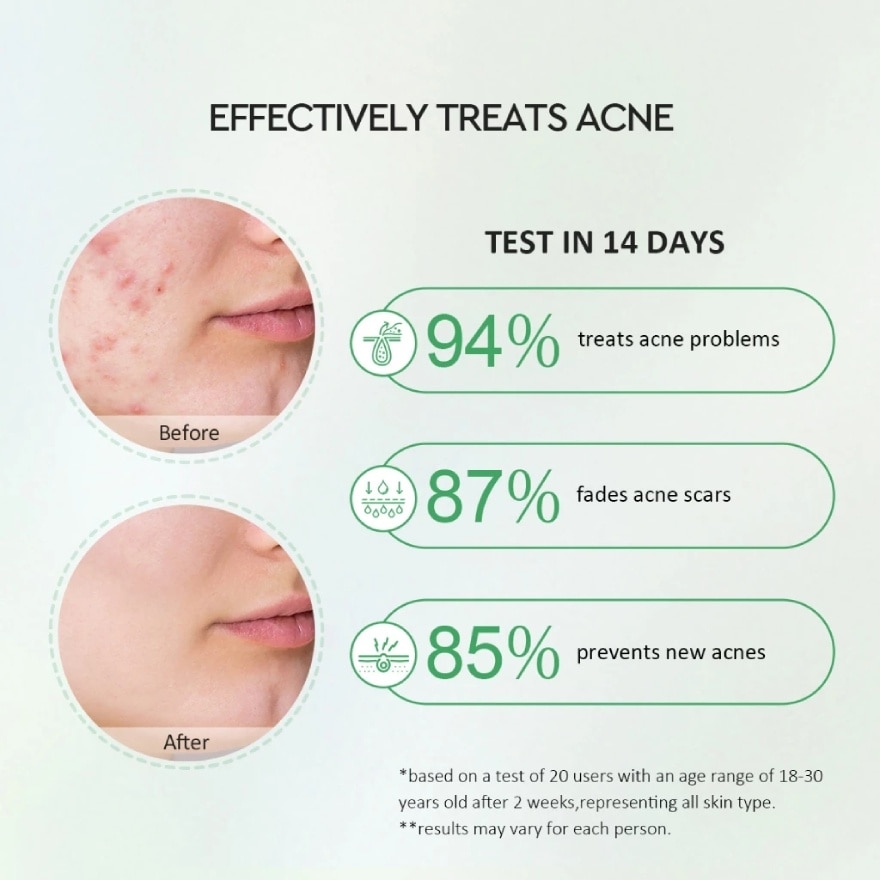 Centella Salicylic Acid Acne Kit (Serum 17ml + Moisturizer 30g)