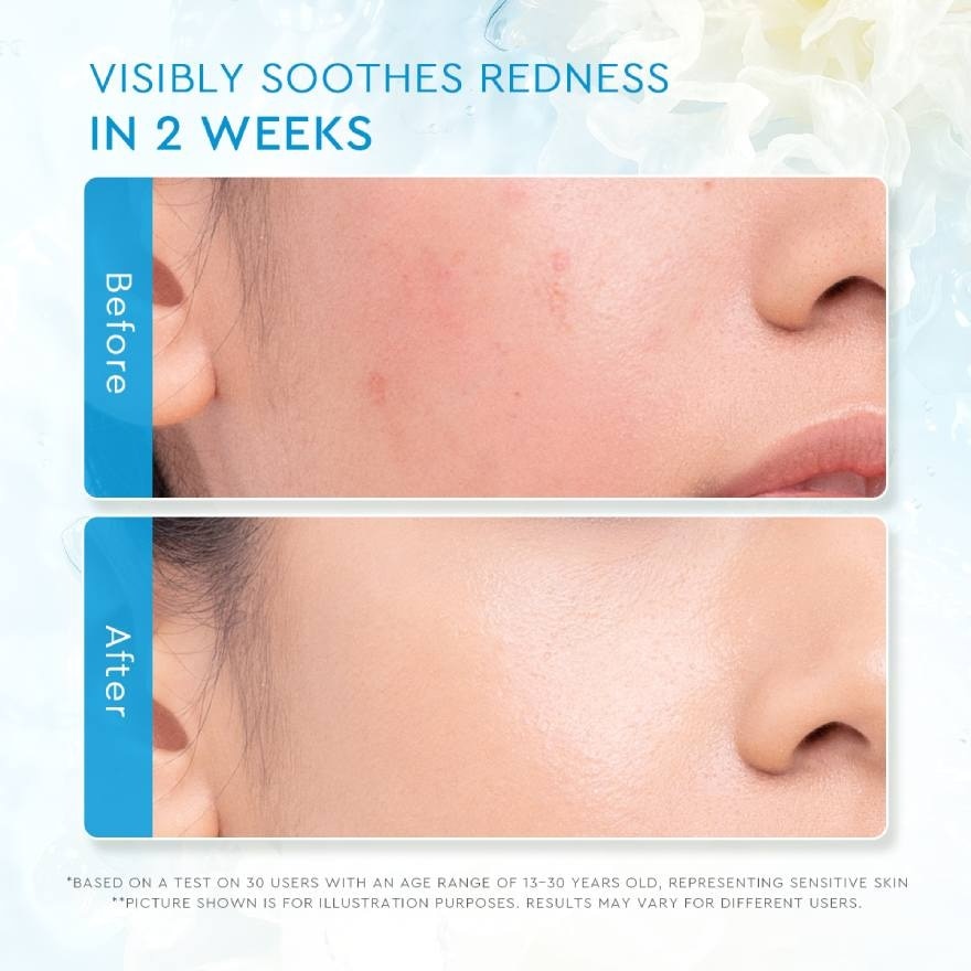 Tremella Vita B5 Sensitive Calming Moisturizer 30g