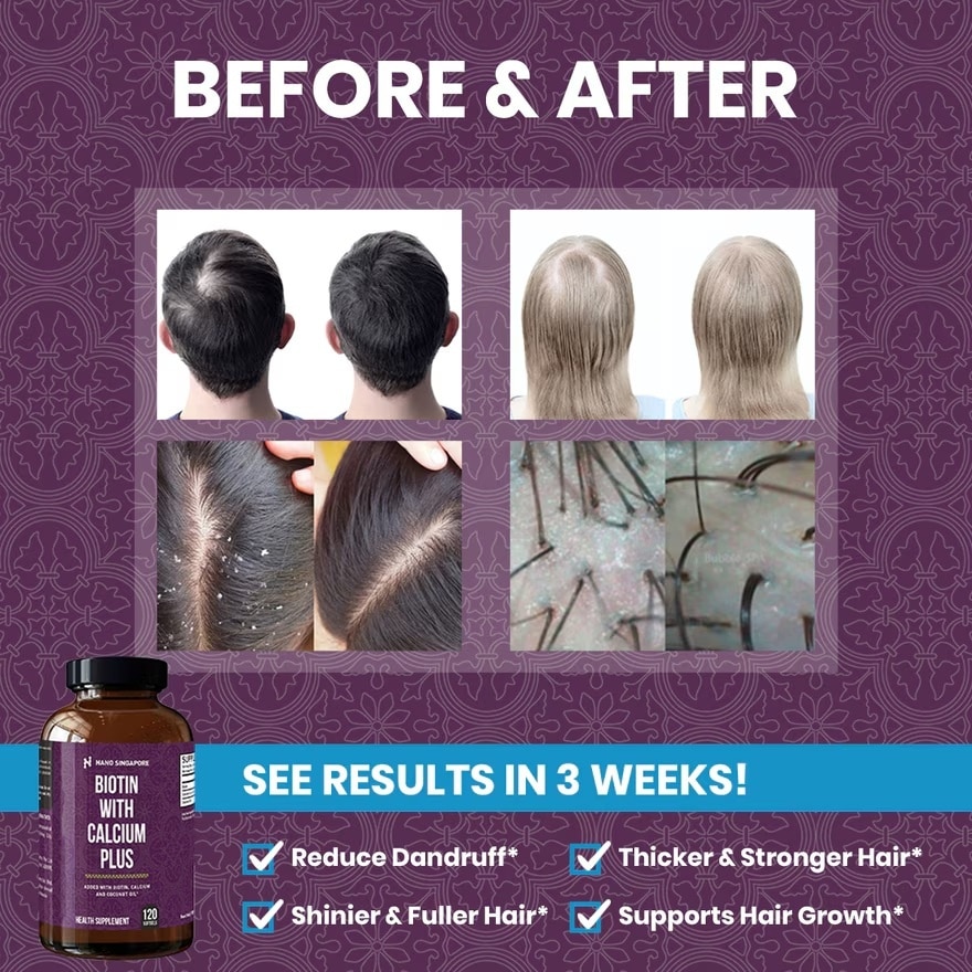 Biotin with Calcium 12120mcg - Hair Vitamins For Hair Loss + Coconut Oil