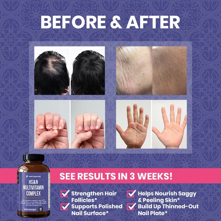 Hair Loss Vitamins Hair Skin Nails - 27 Hair Vitamins, Vitamin C, Biotin, Hair Growth