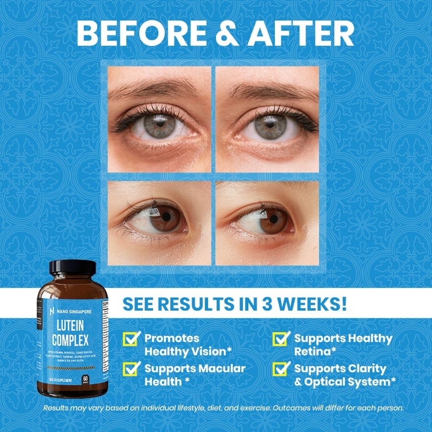 Lutein Complex Vitamins For Eye – Zeaxanthin + Bilberry + Grape Seed + Lycopene