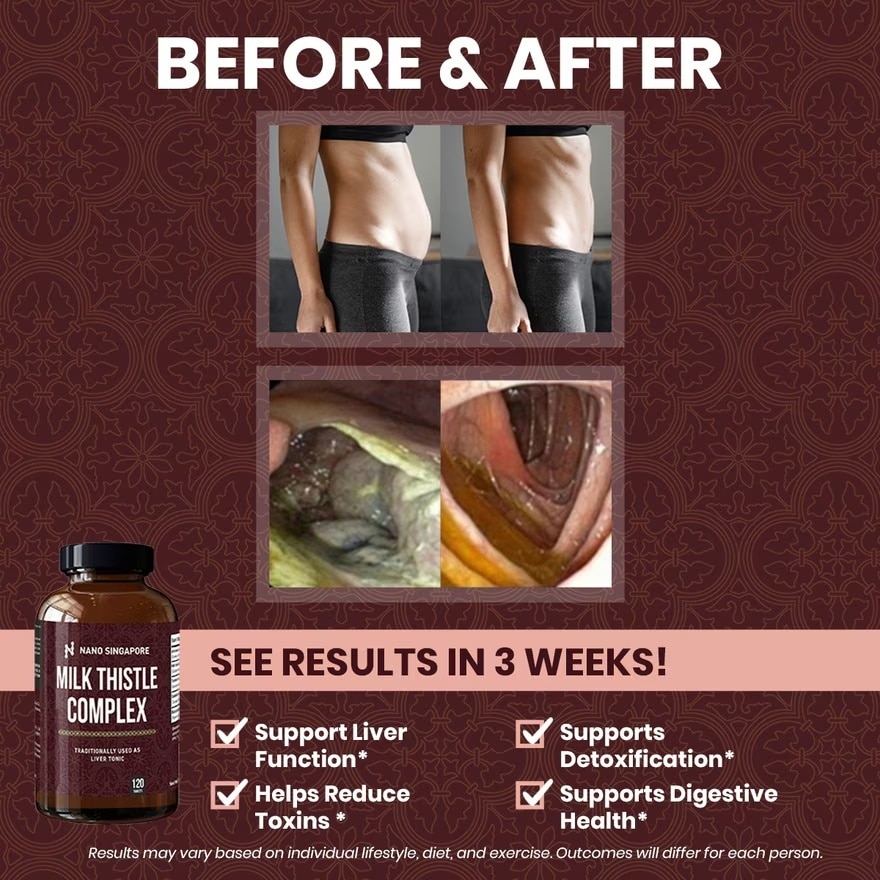 Milk Thistle Complex - Liver Detox, Liver Health Support, Liver Cleansing